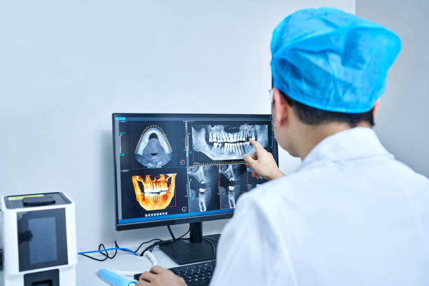 Best Emergency Dental Care for Broken or Chipped Teeth in Ovid, MI